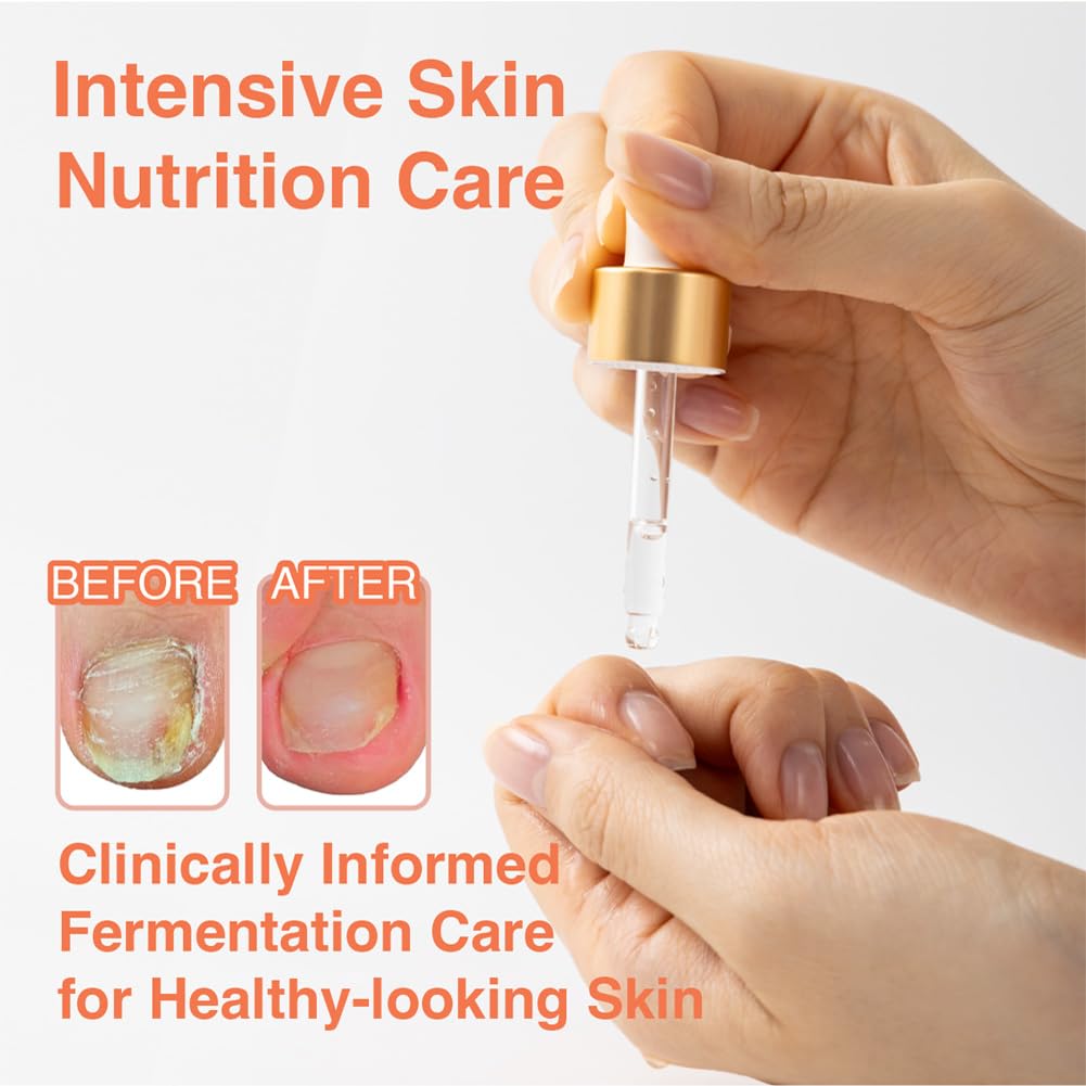 Fermented Nail Oil for Cuticle & Nail Repair | 8ml